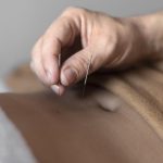 De forensisch wetenschapper verklaarde dat acupunctuur werkt door zelfhypnose de-forensisch-wetenschapper-verklaarde-dat-acupunctuur-werkt-door-zelfhypnose.jpg